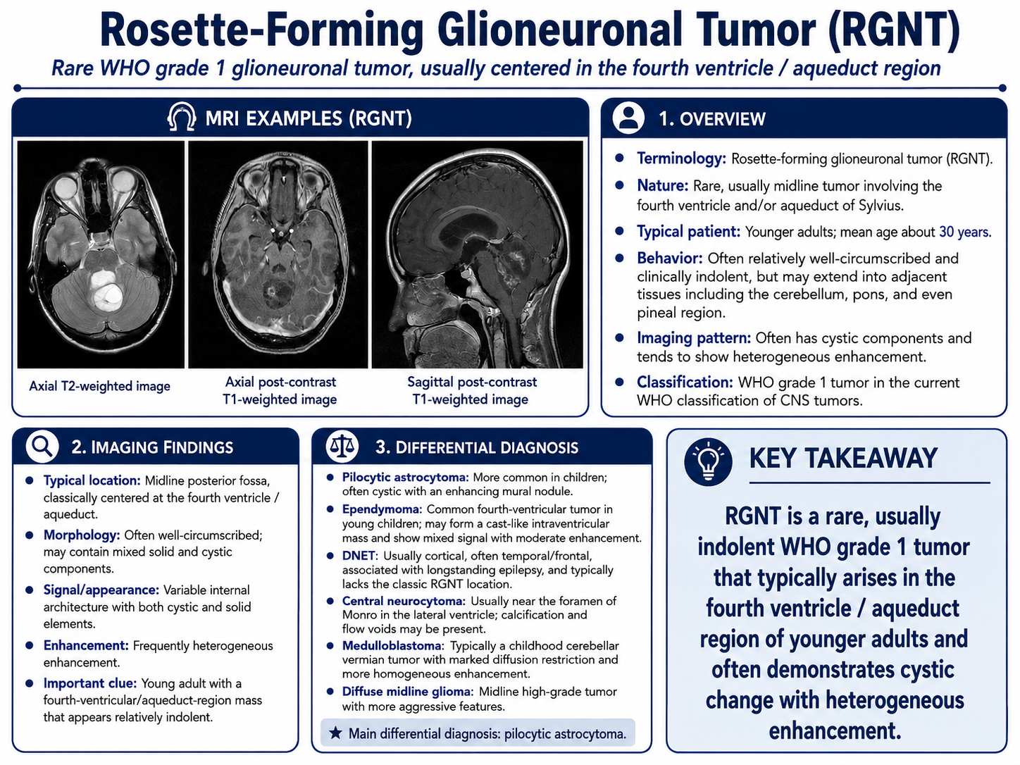 Rosette-forming glioneuronal tumor RGNT